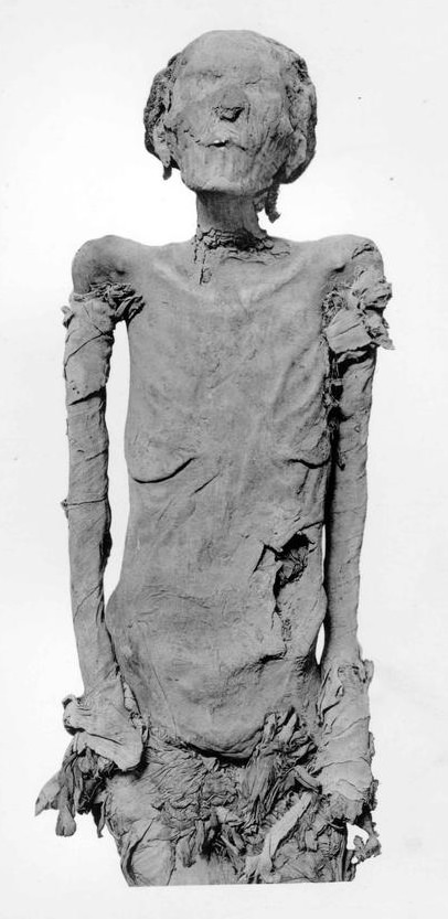 A mummy of an Egyptian woman. She's mostly unwrapped with the remains of linen wrappings around her arms and lower body.